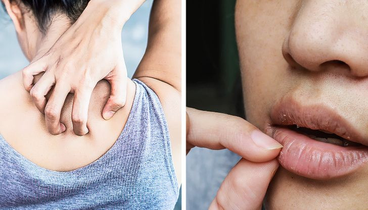 5. Zvogëlon inflamacionin.